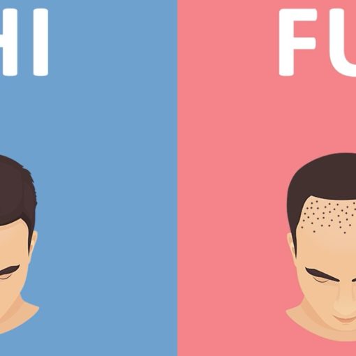Пересадка волос в Турции. Методы FUE и DHI